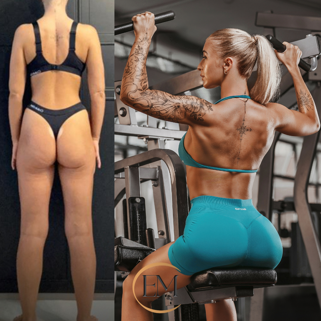 Katie's Transformation